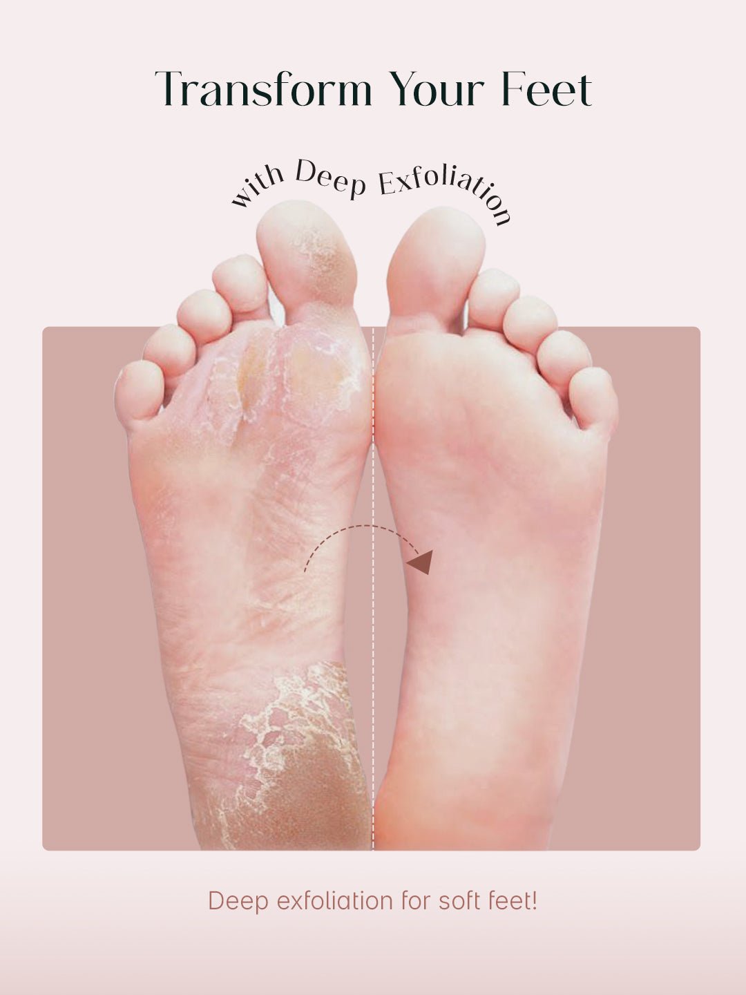 SeoulSkin™ SmoothPeel Foot Mask | BOGO Offer - Image 2