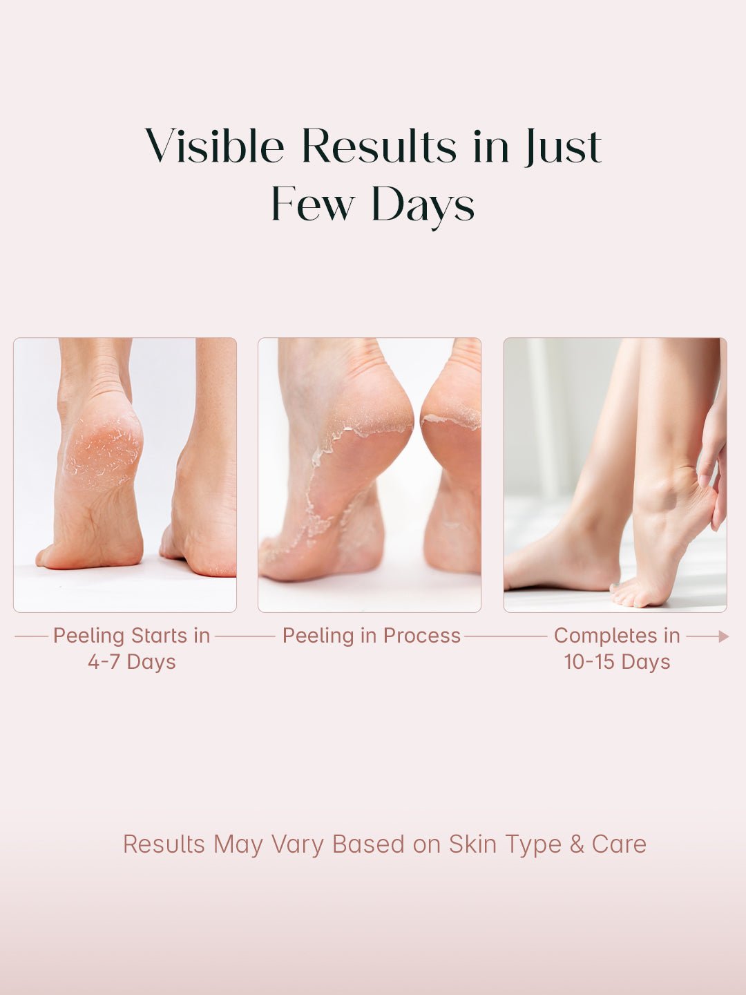 SeoulSkin™ SmoothPeel Foot Mask | BOGO Offer - Image 5