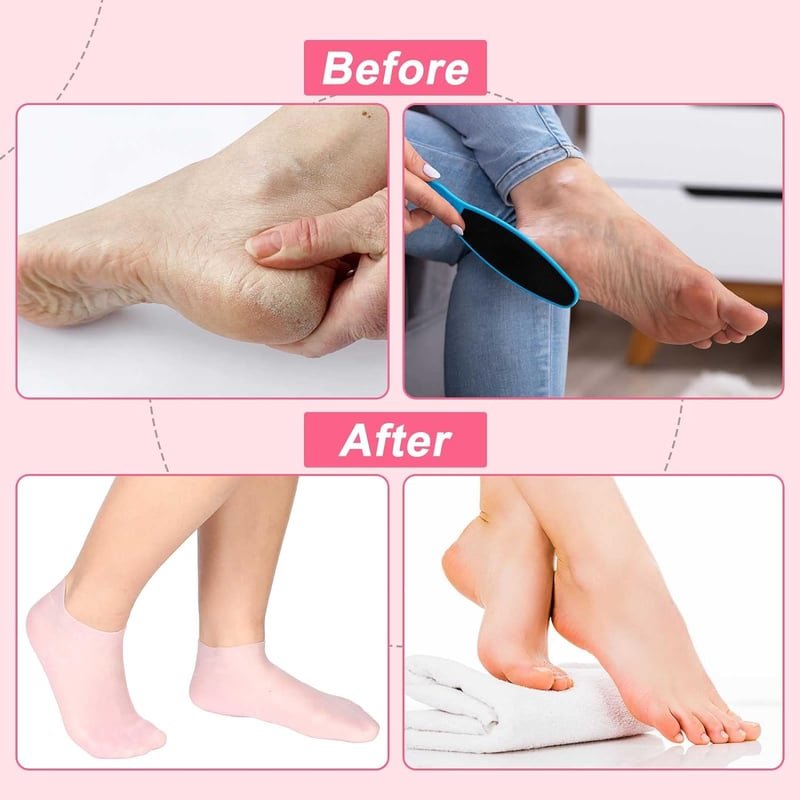 SoftStep™ Silicone Spa Socks | BOGO Offer - Image 3