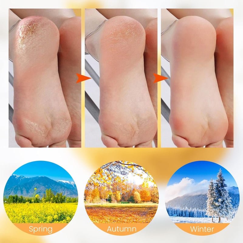 SoftStep™ Silicone Spa Socks | BOGO Offer - Image 6