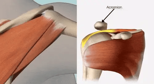 Orthopedic Compression Shoulder Brace (75% OFF) - Image 5
